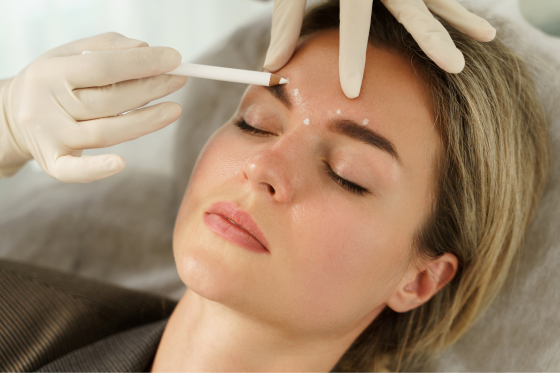 Botox and filler treatments at Back to 30 Greenville SC