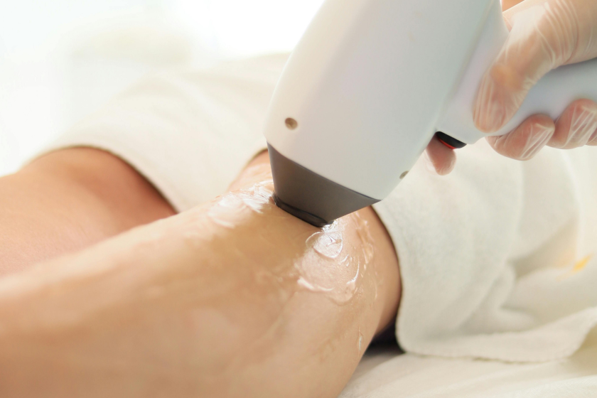 Back to 30 Body — laser hair removal specials